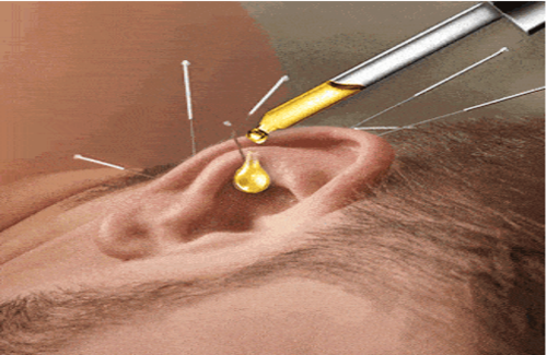 Sluh kakav treba biti: Revolucionarna metoda za Vaše uši